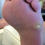 cor plantaire - soins des pieds kathy ouellet